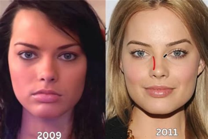 Before And After Surgery Insights Revealed