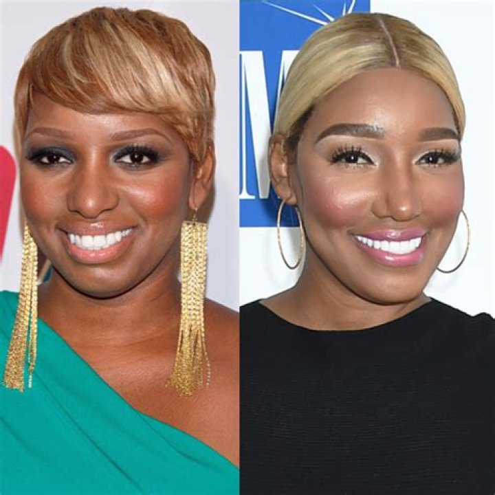 NeNe Leakes Spills Plastic Surgery Confessions On Wendy Williams Hollywood Life |