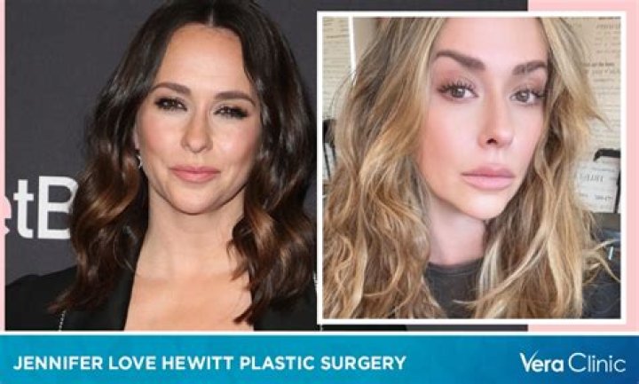Unveiling Jennifer Love Hewitt's Plastic Surgery Secrets: Discoveries And Insights