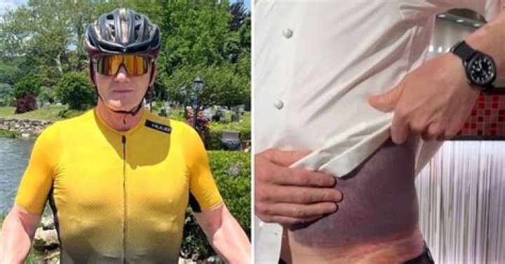 Unveiling The Tragic Details And Lessons Of Scott Palmer's Cycling Accident
